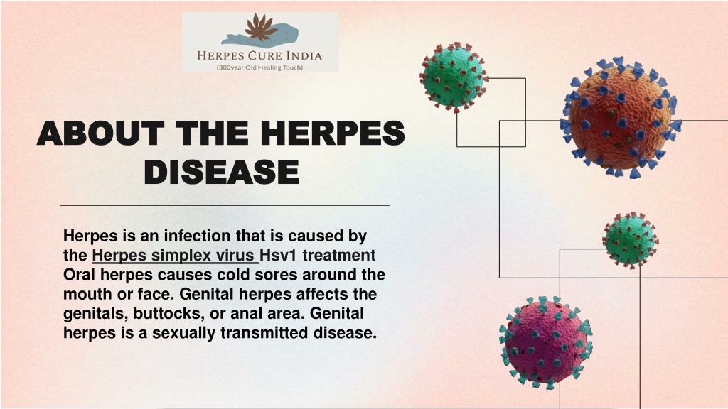 Ppt Herpes Cure In India Free Ayurvedic Herpes Treatment In India