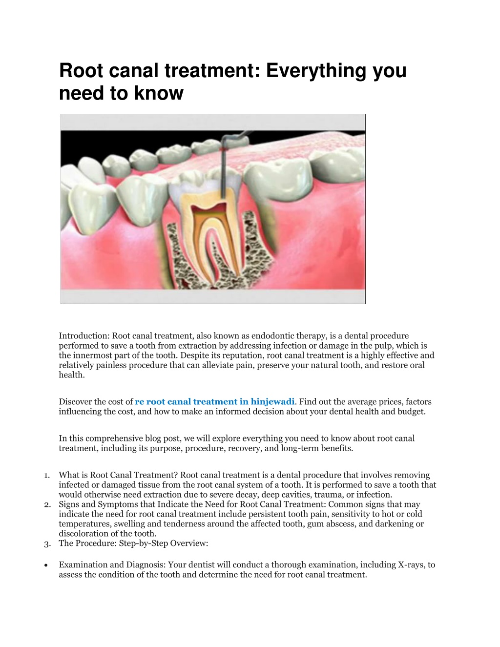 Ppt Root Canal Treatment Everything You Need To Know Powerpoint