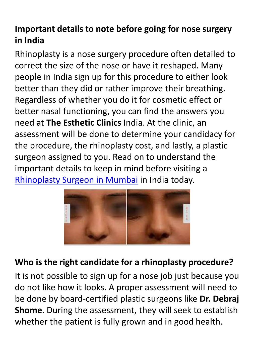 Ppt Rhinoplasty Treatment In Mumbai Powerpoint Presentation Free