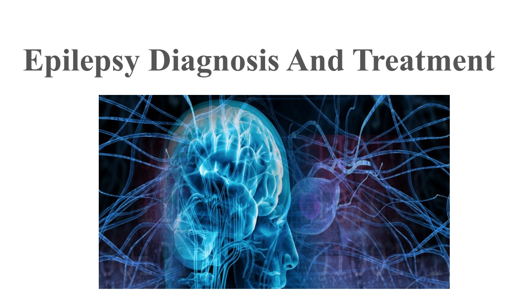 PPT - Epilepsy Diagnosis And Treatment PowerPoint Presentation, Free ...