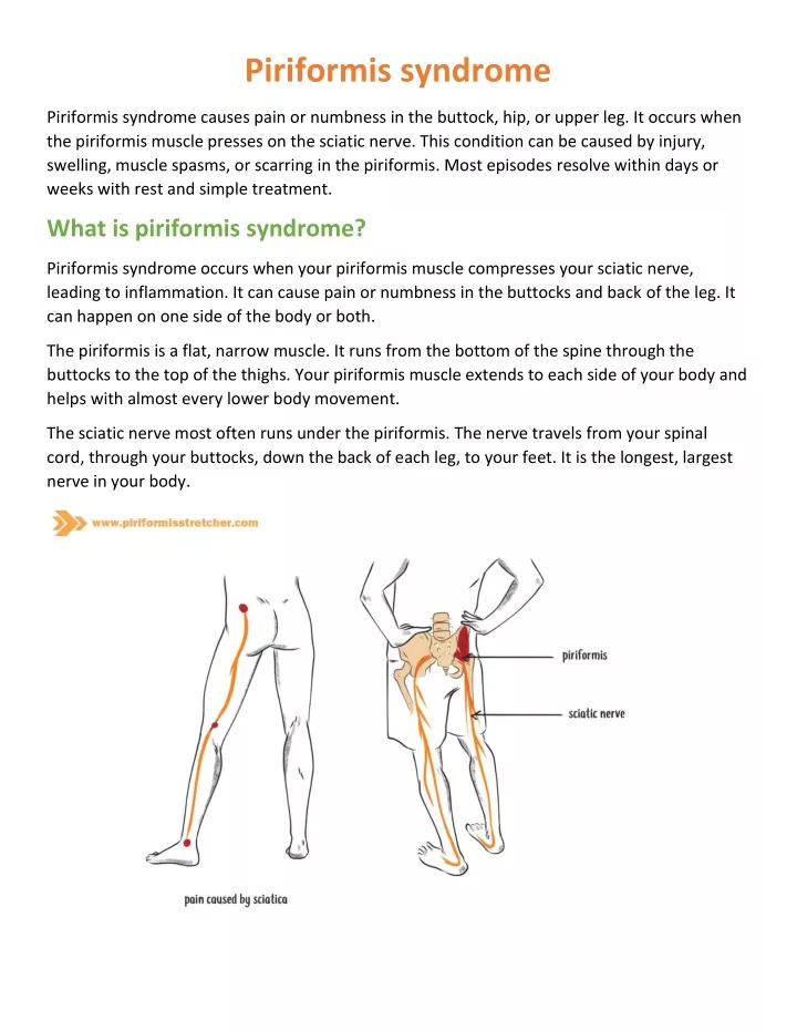 Ppt Piriformis Syndrome Vs Sciatica Cause Symptoms How To Self Release Pdf Powerpoint