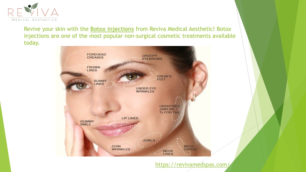 PPT Botox injections PowerPoint Presentation, free download ID12166063
