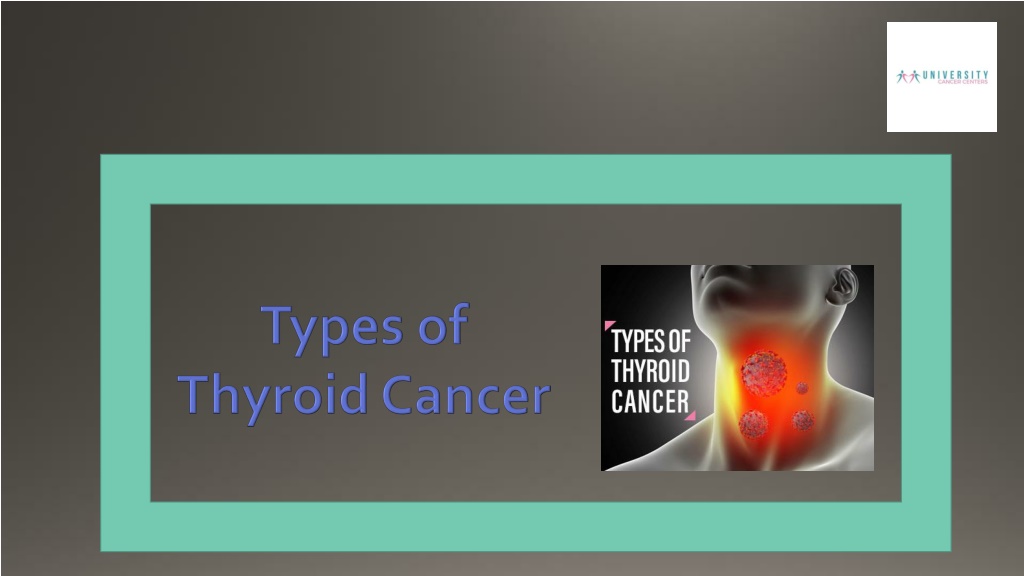PPT - Types of Thyroid Cancer PowerPoint Presentation, free download ...