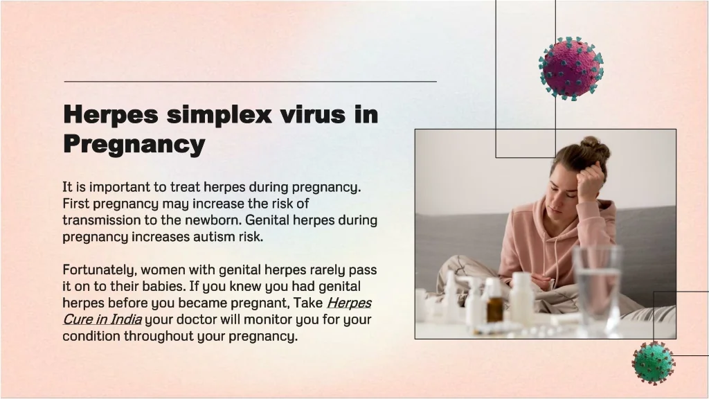 PPT Herpes Cure in India Free Ayurvedic Herpes treatment in India