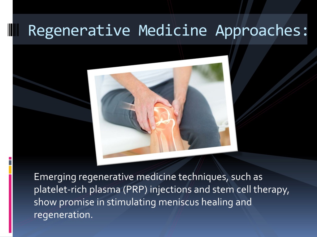 Ppt Innovations In Knee Meniscus Treatment Powerpoint Presentation Free Download Id