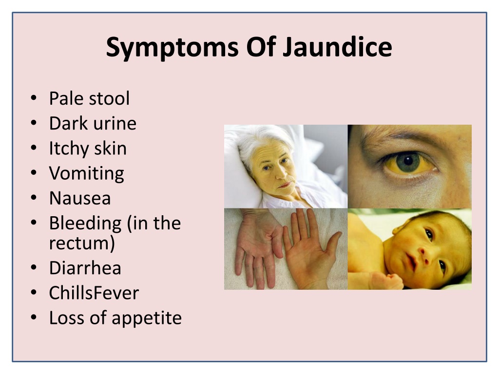 Ppt Jaundice And Liver Care Jaundinil Capsule Powerpoint Presentation Id12185682 2480