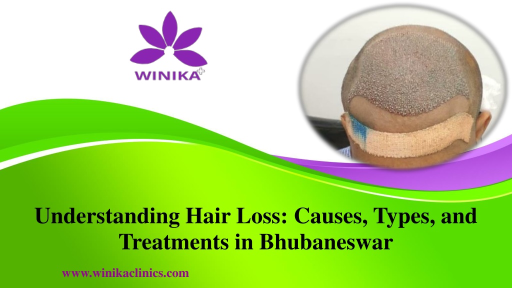 Ppt Understanding Hair Loss Causes Types And Treatments In Bhubaneswar Powerpoint 