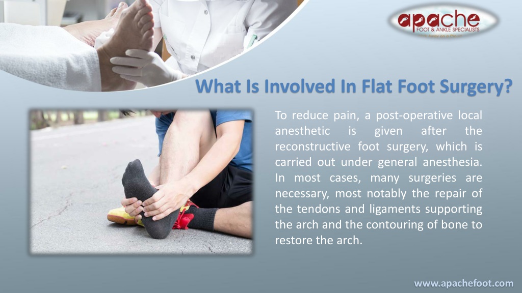 PPT - All That You Need To Know About Flat Foot Reconstruction Surgery ...