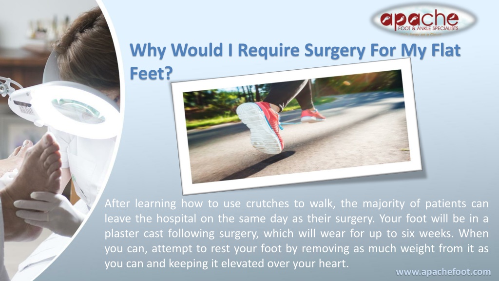 PPT - All That You Need To Know About Flat Foot Reconstruction Surgery ...