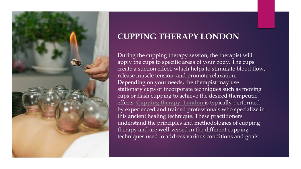 Ppt Cupping Therapy London Powerpoint Presentation Free Download