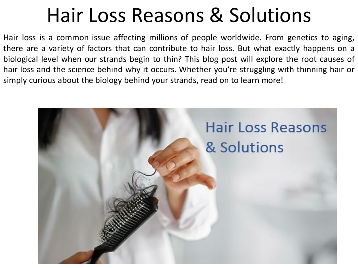 Ppt Hair Loss Factors And Treatments Powerpoint Presentation Free Download Id 12242023