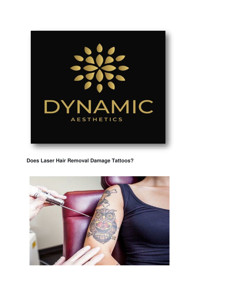 PPT Does Laser Hair Removal Damage Tattoos PowerPoint Presentation