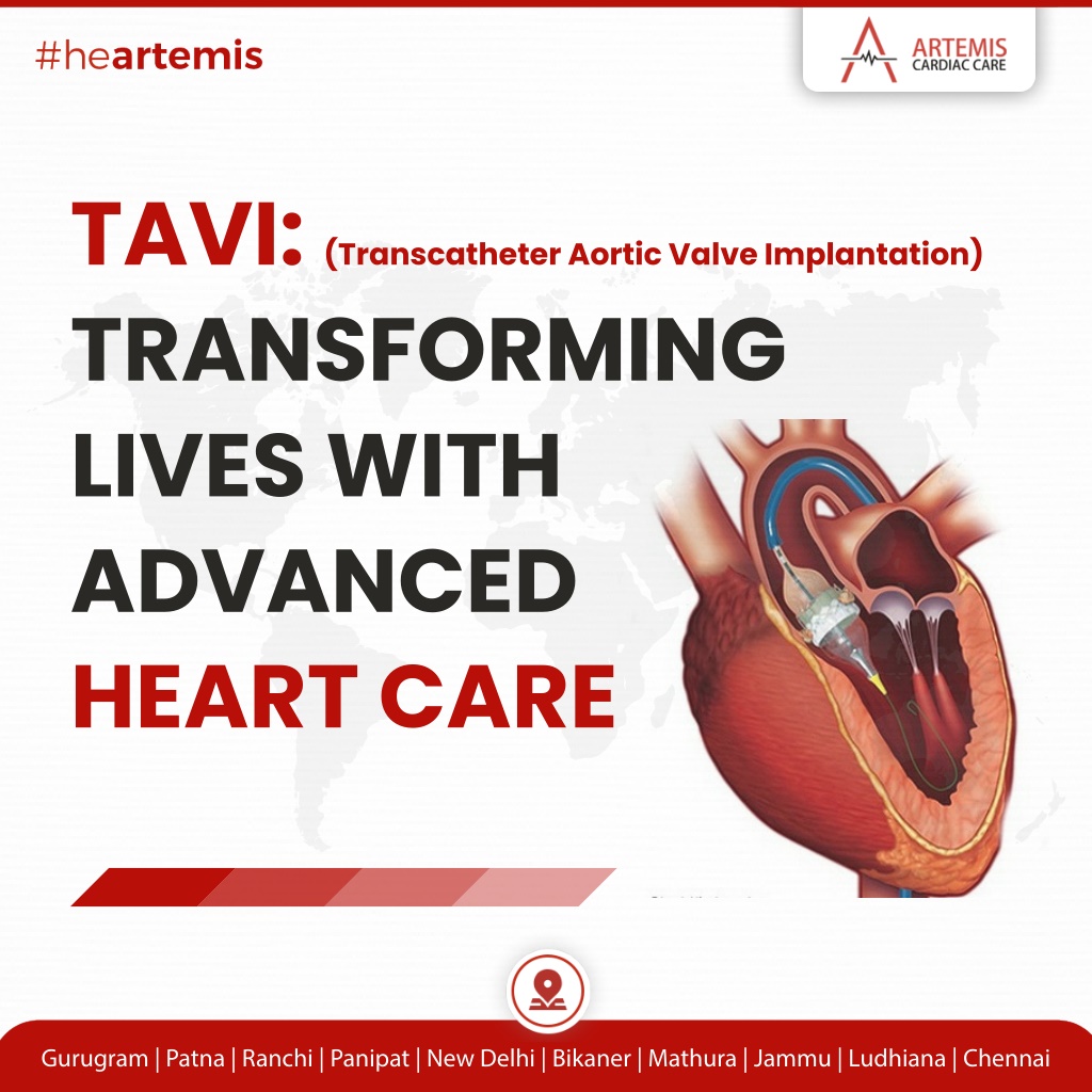 PPT - Revolutionizing Heart Care: Transcatheter Aortic Valve ...