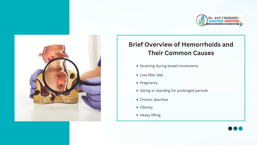 Ppt Brief Overview On Hemorrhoid Treatment Powerpoint Presentation Free Download Id12399413 