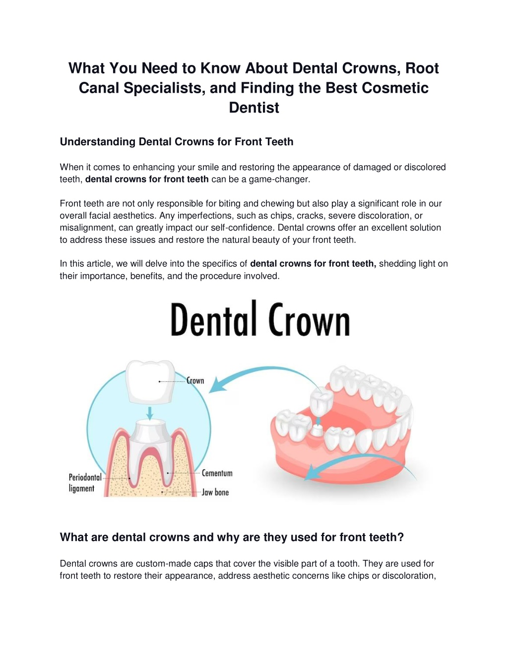 PPT - What You Need to Know About Dental Crowns, Root Canal Specialists,  and Finding the Best Cosmetic Dentist PowerPoint Presentation - ID:12429419
