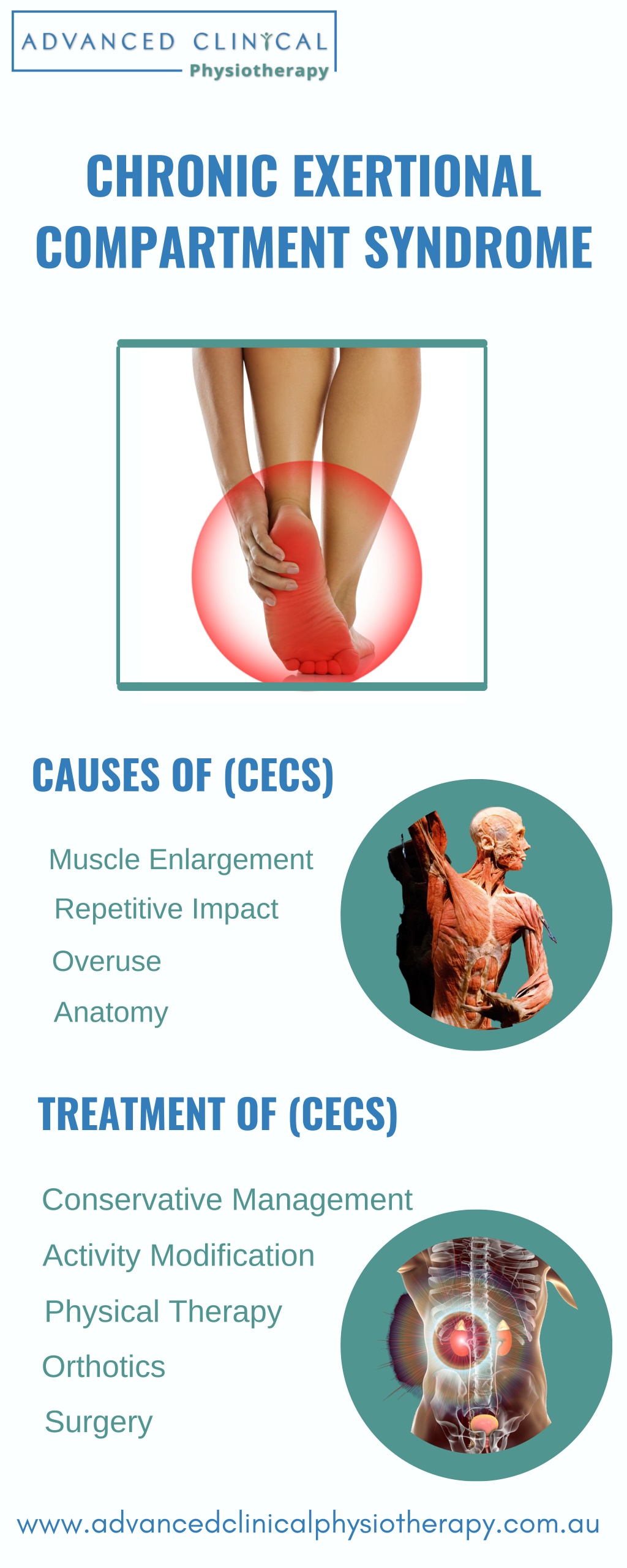 Ppt Chronic Exertional Compartment Syndrome Powerpoint Presentation Free Download Id12458161