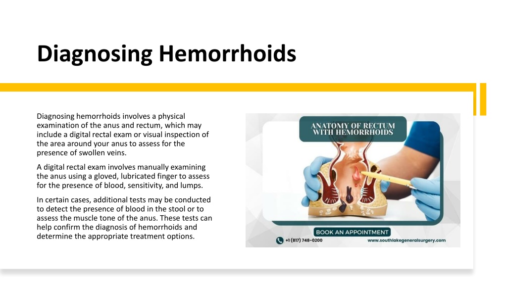 Ppt Hemorrhoids Essential Guide Powerpoint Presentation Free