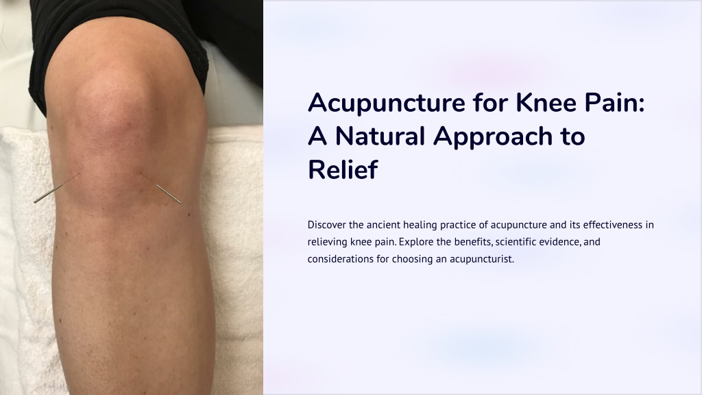 Ppt Acupuncture For Knee Pain A Natural Approach To Relief