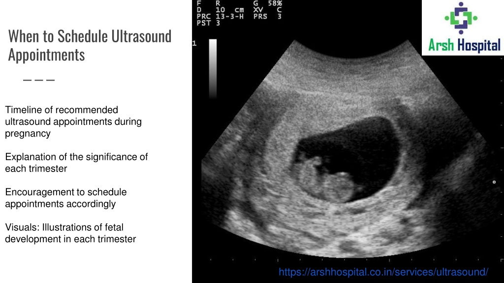 PPT - pregnancy ultrasound in faridabad PowerPoint Presentation, free ...