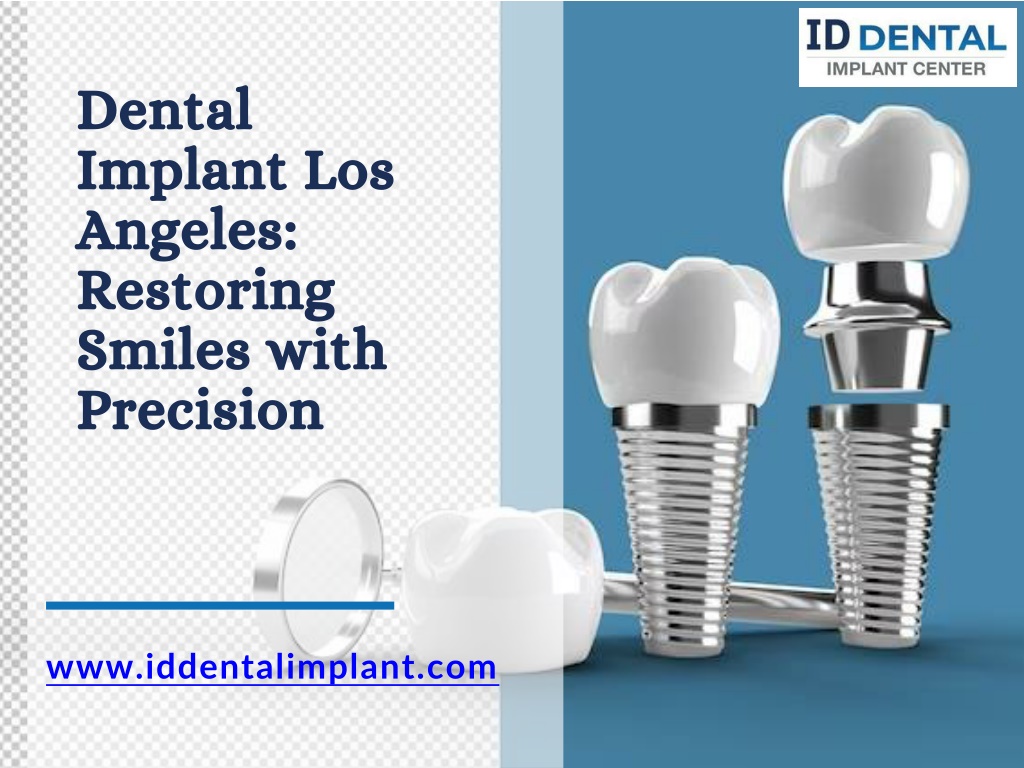 PPT Dental Implant Los Angeles Restoring Smiles With Precision PowerPoint Presentation ID
