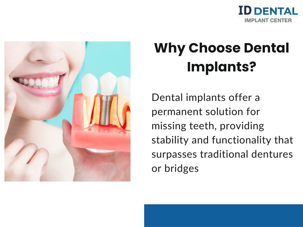 Ppt Dental Implant Los Angeles Restoring Smiles With Precision Powerpoint Presentation Id