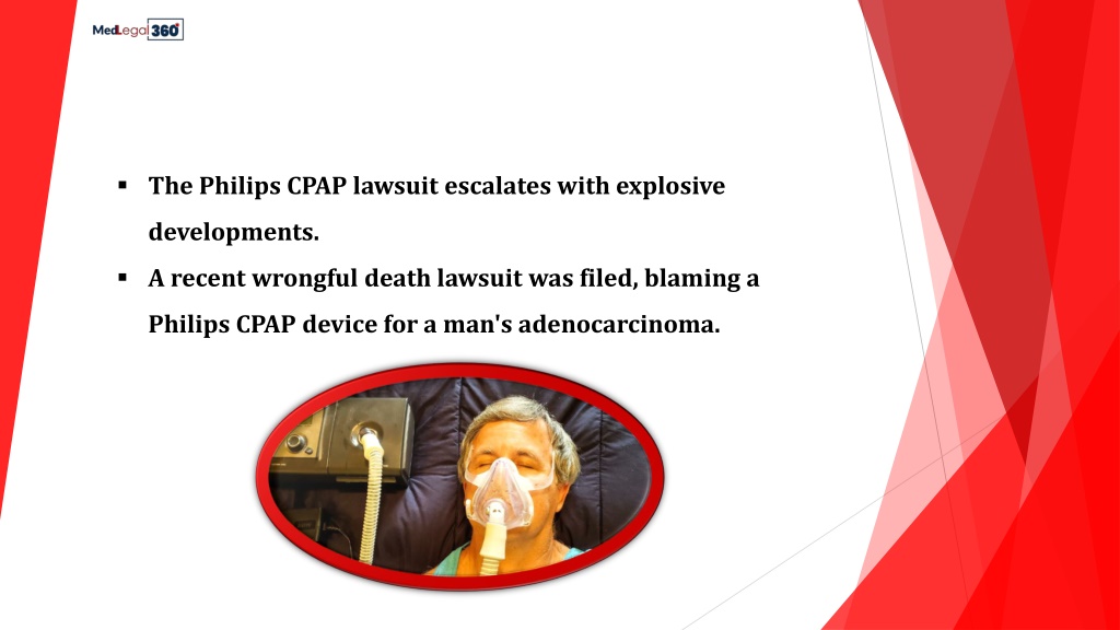 PPT - Philips CPAP Lawsuit Update: Key Updates In 2024 PowerPoint ...