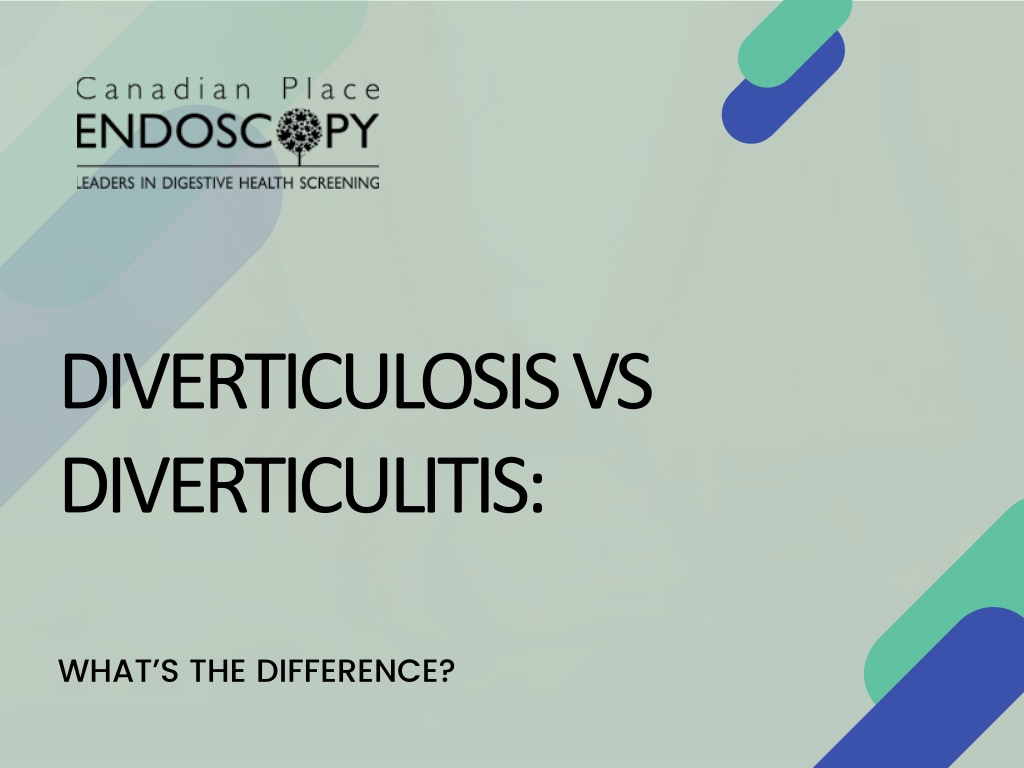 PPT - Diverticulosis Vs. Diverticulitis: What's The Difference? PowerPoint  Presentation - ID:12913761