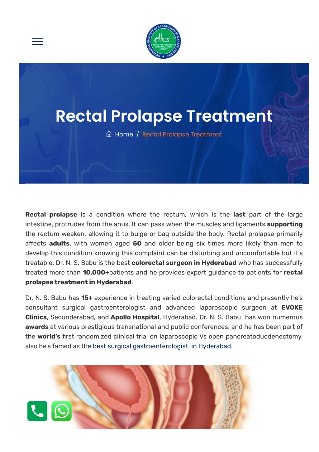 Ppt Rectal Prolapse Treatment In Hyderabad Powerpoint Presentation Free Download Id13025537 