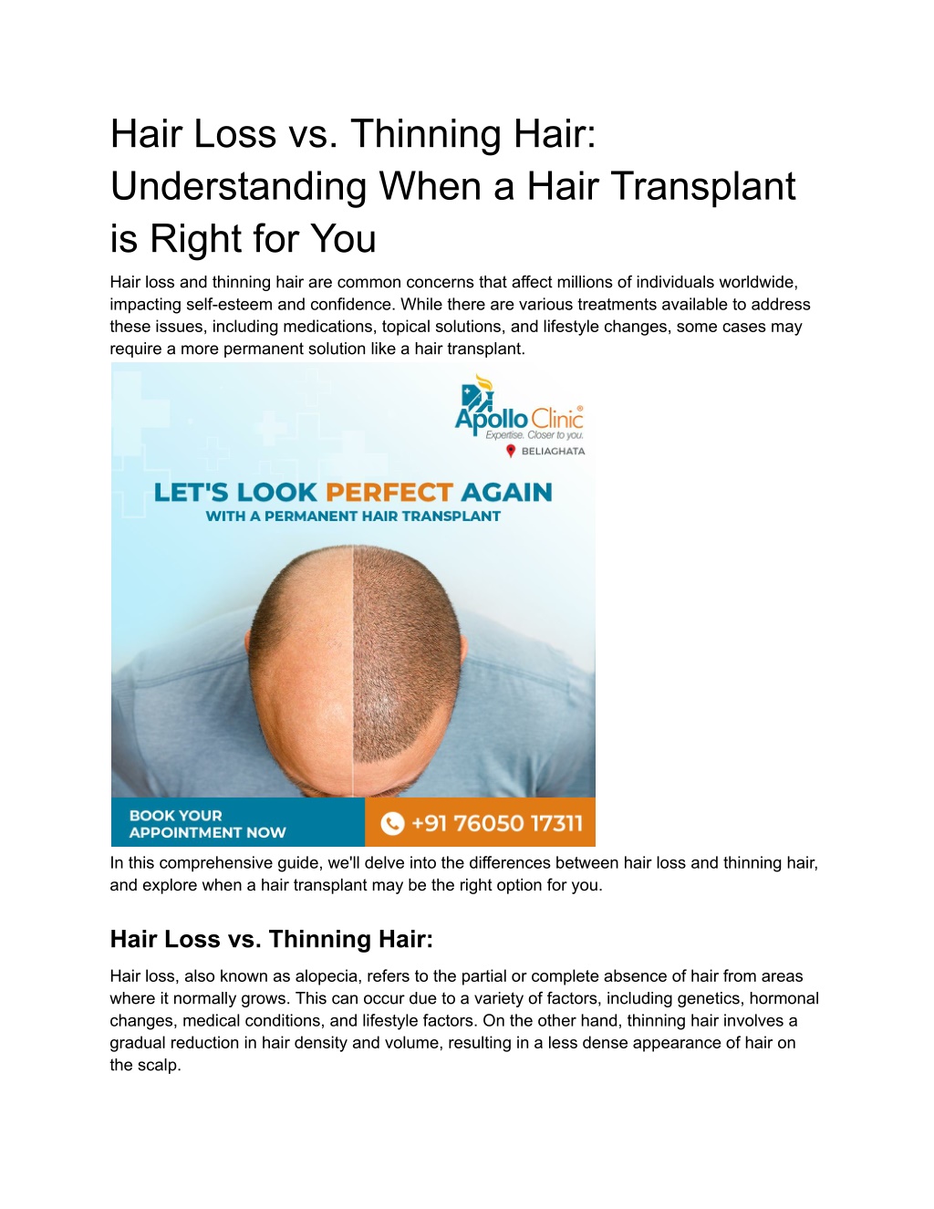 Ppt Hair Transplant Vs Thinning Hair Understanding When Its Time For A Solution Powerpoint