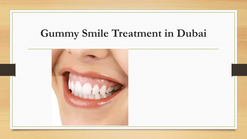 PPT - Gummy Smile Treatment in Dubai PowerPoint Presentation, free ...