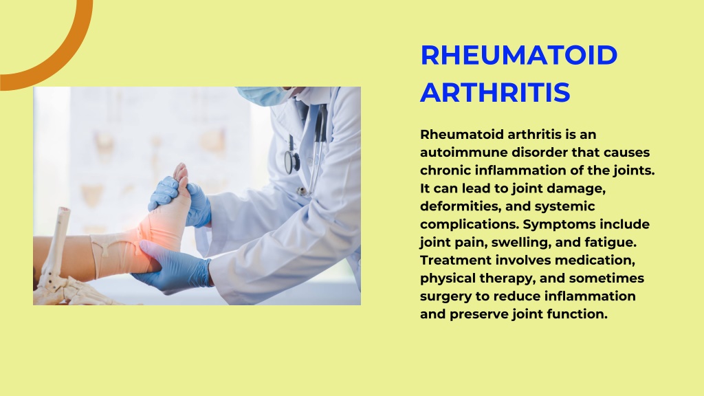 PPT - UNDERSTANDING 5 COMMON ORTHOPEDIC DISORDERS PowerPoint ...