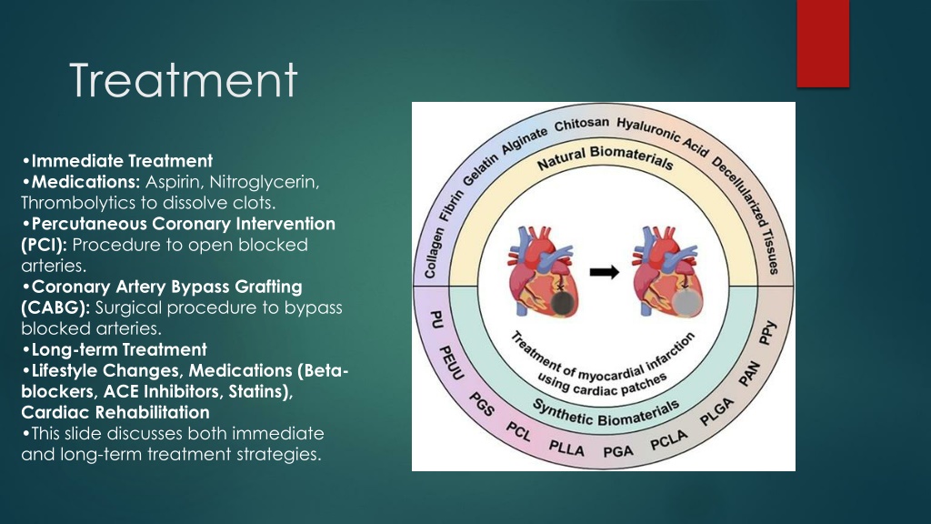 Ppt Understanding Myocardial Infarction Pathophysiology Diagnosis And Treatment Powerpoint