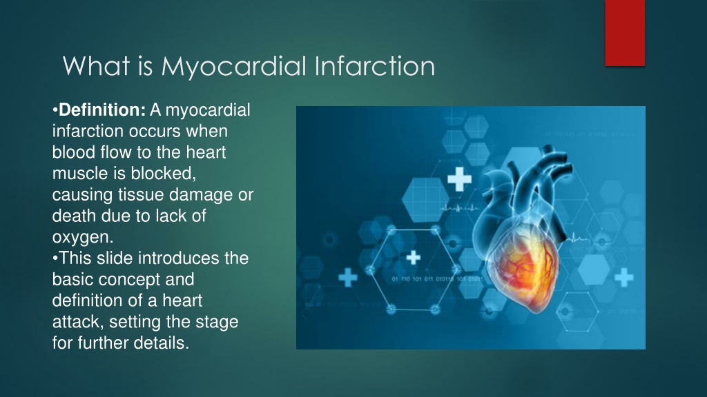 PPT - Understanding Myocardial Infarction: Pathophysiology, Diagnosis ...