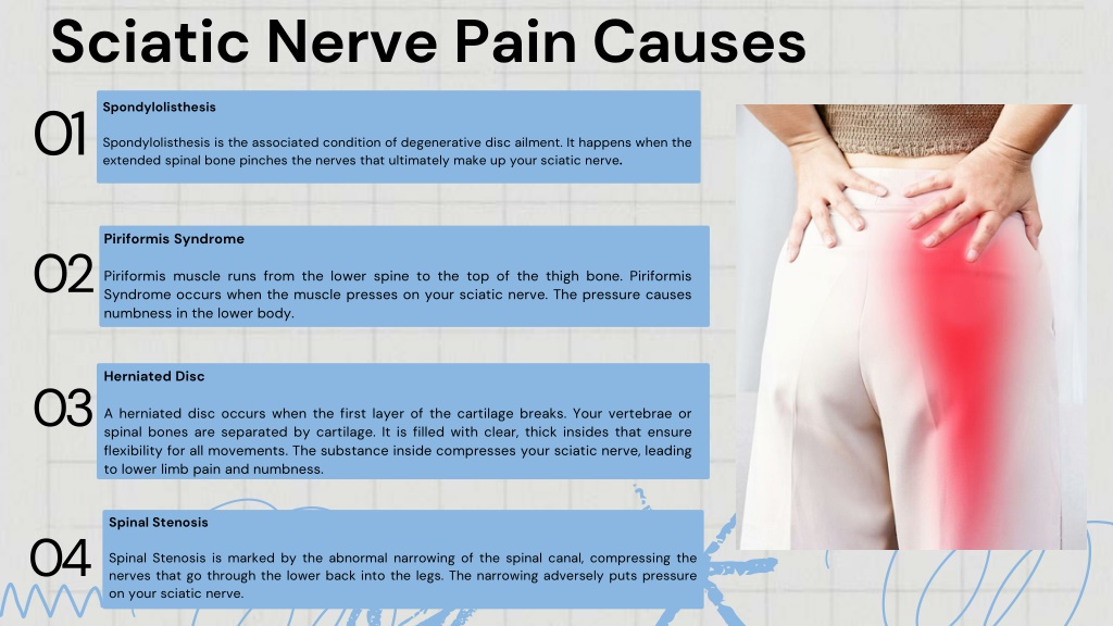 PPT - Sciatica Nerve Pain Treatment PowerPoint Presentation, free ...