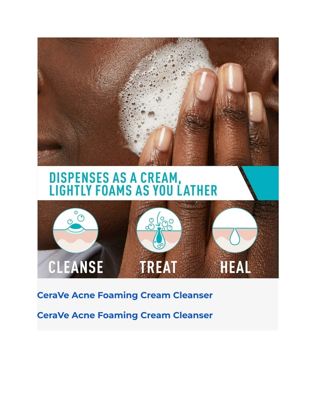 PPT - CERAVE ACNE FOAMING CREAM CLEANSER PowerPoint Presentation, free ...