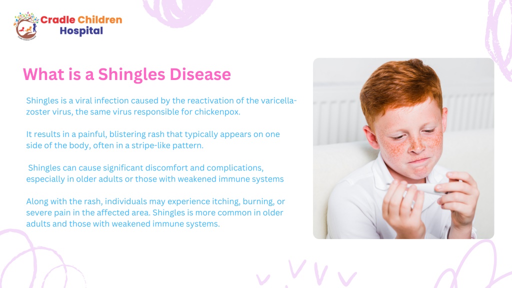 Ppt - What Are Shingles What Are The Signs & Causes Of It Powerpoint 