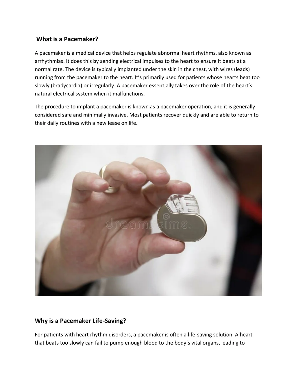 Pacemaker Quotation PPT - Pacemaker Operation in Dubai PowerPoint Presentation, free ...